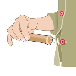 ADL aankleedhulp knoop patiënt hand jas illustratie