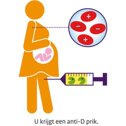 anti-D prik moeder kind rhesus antistoffen bloed zwangerschap illustratie schematisch pictogram