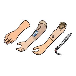arm prothese illustratie