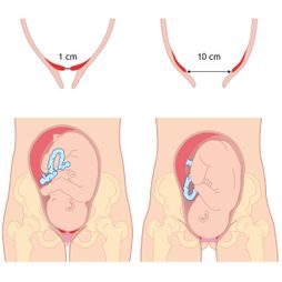 baby zwangerschap geboorte ontsluiting stadia centimeters baby kind moeder baarmoeder bekken illustratie