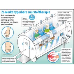  	hyperbare zuurstof therapie lymfoedeem patienten zuurstof masker O2 ademen cabine haarvaten weefsel voedingsstoffen genezing infographic vector illustratie
